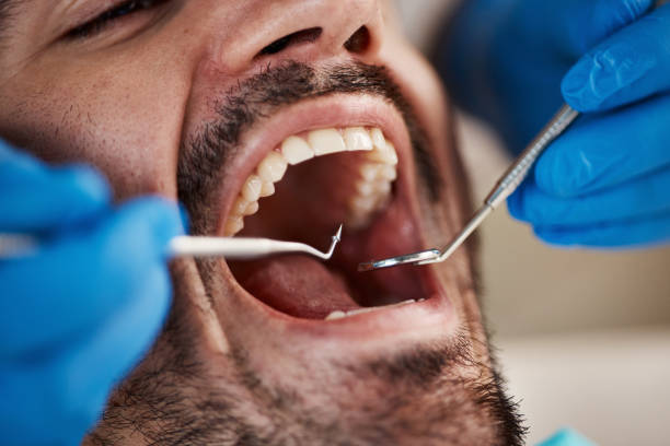 Best Emergency Dental Care for Trauma or Injury in Skyline Ganipa, NM